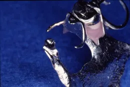 部分入れ歯(パーシャルデンチャー)05