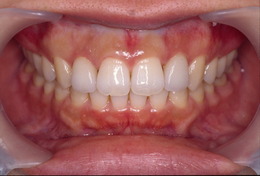 矯正歯科治療症例 After
