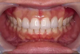 矯正歯科治療症例 After